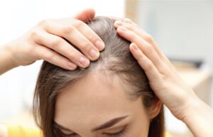 Genetics In Hair Loss And Restoration