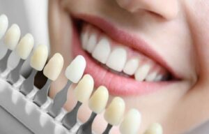 cosmetic dentistry in Lincoln,